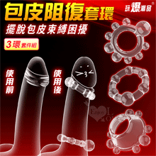 玩爆潮品 ‧ 包皮阻復情趣套環-物理降低敏感度﹝不同款式-3入組裝﹞
